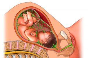 Chlamydie v těhotenství: cesty infekce, příznaky, léčba